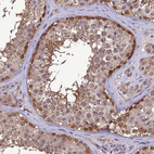 Anti-PSMF1 Antibody