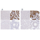 Immunohistochemical staining of human liver, salivary gland, skeletal muscle and testis using Anti-ZG16B antibody HPA041125 (A) shows similar protein distribution across tissues to independent antibody HPA053549 (B).