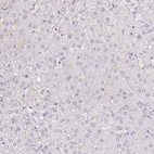 Immunohistochemical staining of human liver shows no positivity in hepatocytes as expected.
