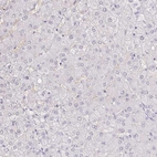 Immunohistochemical staining of human liver shows no positivity in hepatocytes as expected.