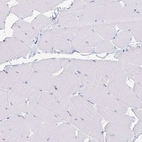 Immunohistochemical staining of human skeletal muscle shows no positivity in myocytes as expected.