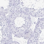 Immunohistochemical staining of human testis shows no positivity in cells in seminiferous ducts as expected.
