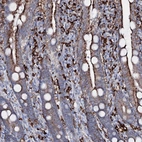 Anti-OSBPL2 Antibody
