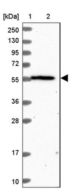 Lane 1: Marker [kDa] 250, 130, 95, 72, 55, 36, 28, 17, 10_br/_Lane 2: Human cell line RT-4