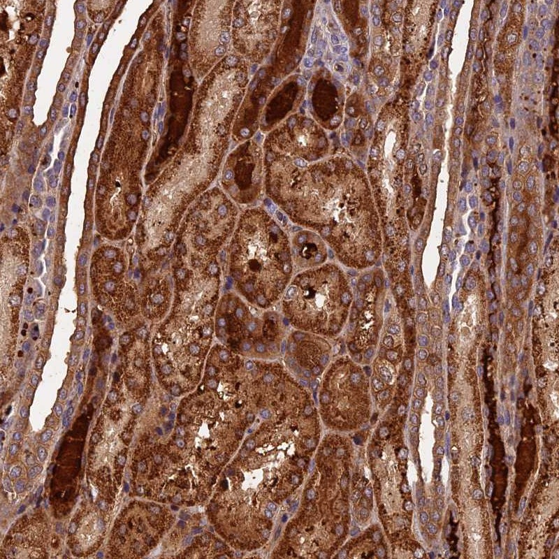 Anti-C16orf70 Antibody