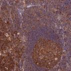 Anti-TRMT1 Antibody