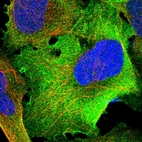 Immunofluorescent staining of human cell line U-2 OS shows positivity in plasma membrane & cytoplasm.
