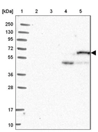 Lane 1: Marker [kDa] 250, 130, 95, 72, 55, 36, 28, 17, 10_br/_Lane 2: Human cell line RT-4_br/_Lane 3: Human cell line U-251MG sp_br/_Lane 4: Human plasma (IgG/HSA depleted)_br/_Lane 5: Human liver tissue
