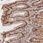 Anti-C16orf46 Antibody