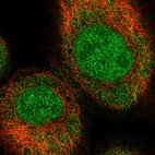 Immunofluorescent staining of human cell line A-431 shows localization to nucleoplasm & cytosol.