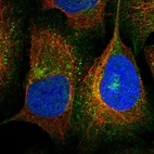 Immunofluorescent staining of human cell line U-2 OS shows localization to endosomes.