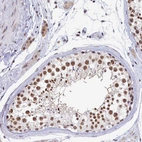 Immunohistochemical staining of human testis shows moderate nuclear positivity in cells in seminiferous ducts.