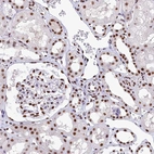 Immunohistochemical staining of human kidney shows moderate nuclear positivity in cells in tubules and cells in glomeruli.