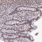 Anti-MOSPD3 Antibody