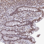Immunohistochemical staining of human colon shows moderate nuclear positivity in glandular cells.
