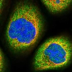 Immunofluorescent staining of human cell line A-431 shows localization to cytosol.