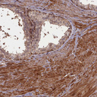 Immunohistochemical staining of human prostate shows moderate to strong cytoplasmic and nuclear positivity in smooth muscle cells.