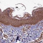 Immunohistochemical staining of human skin shows moderate to strong cytoplasmic and nuclear positivity in squamous epithelial cells.