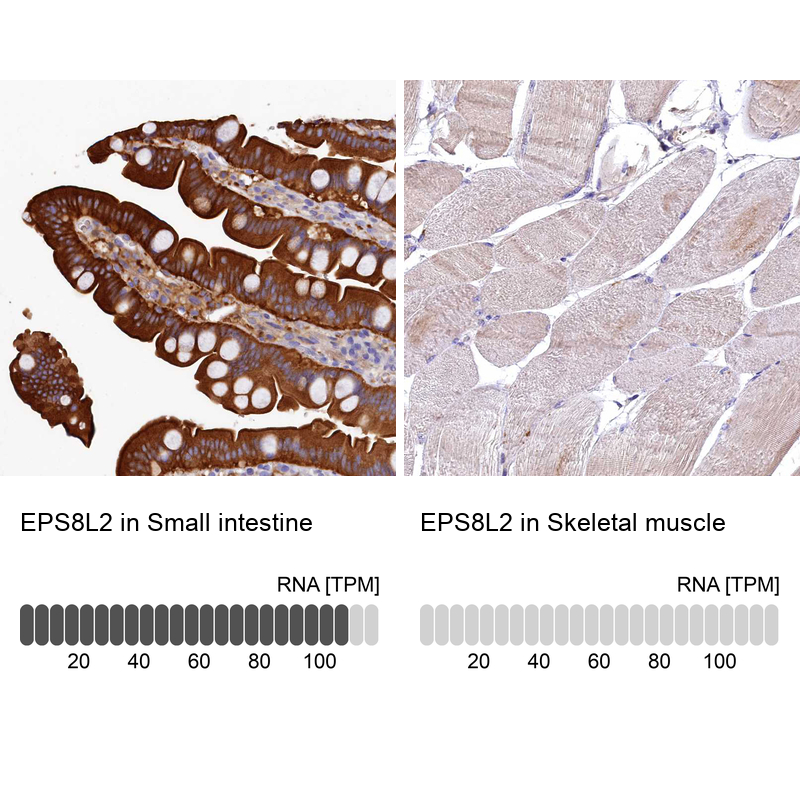 Anti-EPS8L2 Antibody