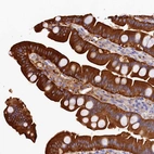 Immunohistochemical staining of human small intestine shows strong cytoplasmic positivity in glandular cells.