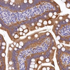 Immunohistochemical staining of human duodenum shows strong cytoplasmic positivity in glandular cells.