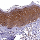 Immunohistochemical staining of human skin shows strong cytoplasmic positivity in epidermal cells.