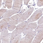 Immunohistochemical staining of human skeletal muscle shows no positivity in myocytes.