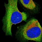 Immunofluorescent staining of human cell line U-2 OS shows localization to plasma membrane & cytosol.