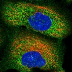 Immunofluorescent staining of human cell line A-431 shows localization to plasma membrane & cytosol.