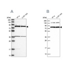 Western blot analysis using Anti-PTCD3 antibody HPA041154 (A) shows similar pattern to independent antibody HPA041382 (B).