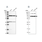 Western blot analysis using Anti-PTCD3 antibody HPA041154 (A) shows similar pattern to independent antibody HPA041382 (B).