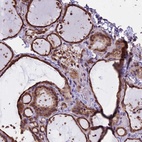 Anti-CHMP2A Antibody