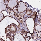 Immunohistochemical staining of human thyroid gland shows high expression.