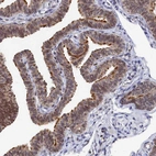 Immunohistochemical staining of human fallopian tube shows strong positivity in cilia in glandular cells.