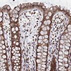 Immunohistochemical staining of human rectum shows moderate cytoplasmic and nuclear positivity in glandular cells.