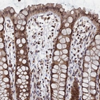 Immunohistochemical staining of human rectum shows moderate cytoplasmic and nuclear positivity in glandular cells.