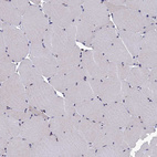 Immunohistochemical staining of human skeletal muscle shows no positivity in myocytes as expected.