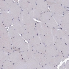 Immunohistochemical staining of human skeletal muscle shows no positivity in myocytes as expected.