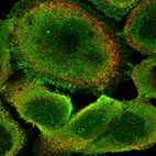 Immunofluorescent staining of human cell line A-431 shows positivity in nucleoli, plasma membrane & cytoplasm.