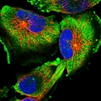 Immunofluorescent staining of human cell line U-251 MG shows localization to plasma membrane, cytosol & centrosome.