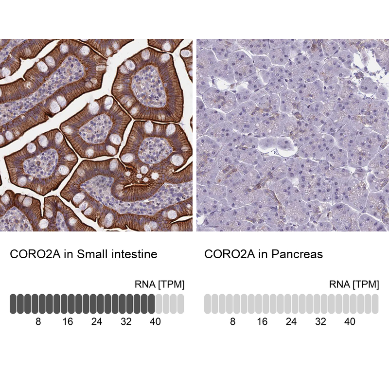 Anti-CORO2A Antibody