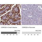 Anti-CORO2A Antibody
