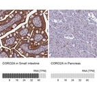 Anti-CORO2A Antibody