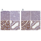Immunohistochemical staining of human liver, pancreas, small intestine and testis using Anti-CORO2A antibody HPA041161 (A) shows similar protein distribution across tissues to independent antibody HPA041302 (B).