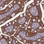 Immunohistochemical staining of human small intestine shows strong membranous and cytoplasmic positivity in glandular cells.