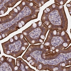 Immunohistochemical staining of human small intestine shows strong membranous and cytoplasmic positivity in glandular cells.