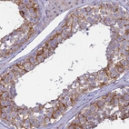 Immunohistochemical staining of human testis shows moderate membranous and cytoplasmic positivity in cells in seminiferous ducts.