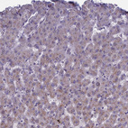 Immunohistochemical staining of human liver shows no positivity in hepatocytes as expected.