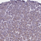 Immunohistochemical staining of human liver shows no positivity in hepatocytes as expected.