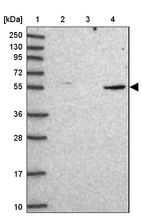 Lane 1: Marker [kDa] 250, 130, 95, 72, 55, 36, 28, 17, 10_br/_Lane 2: Human cell line RT-4_br/_Lane 3: Human cell line U-251MG sp_br/_Lane 4: Human plasma (IgG/HSA depleted)